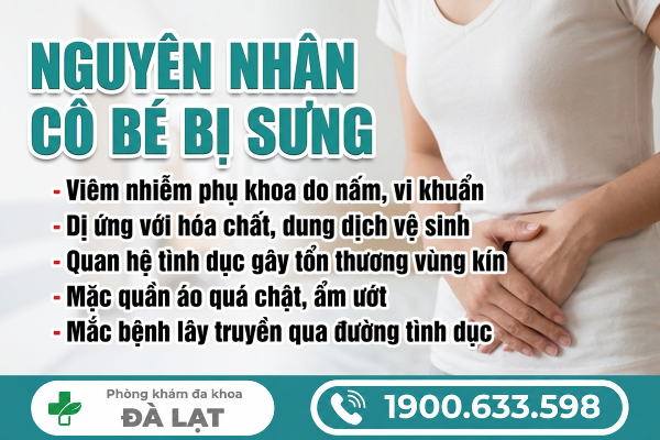 Hình ảnh minh họa